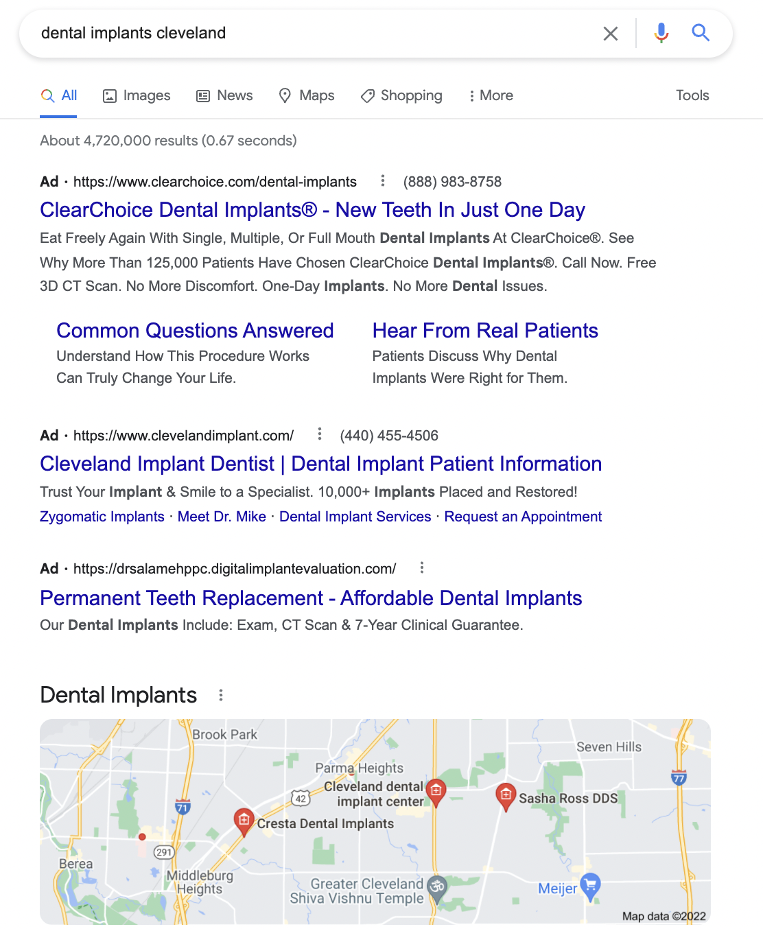 example of google ads for dentists